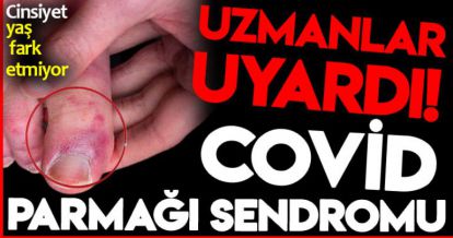 COVİD PARMAĞI SENDROMU!