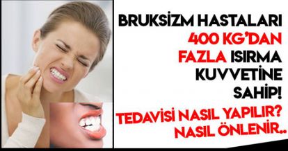 BRUKSİZM HASTALARI 400 KİLOGRAMDAN FAZLA ISIRMA KUVVETİNE SAHİP!