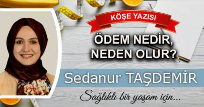 Ödem nedir, neden olur?