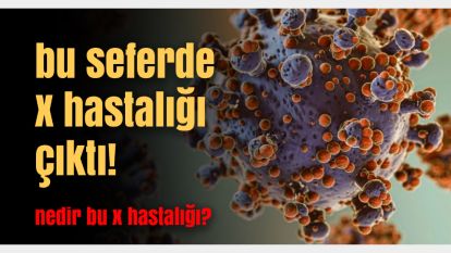 Dünya Sağlık Örgütü uyardı dikkat! X Hastalığı nedir, X Hastalığının belirtileri nelerdir?