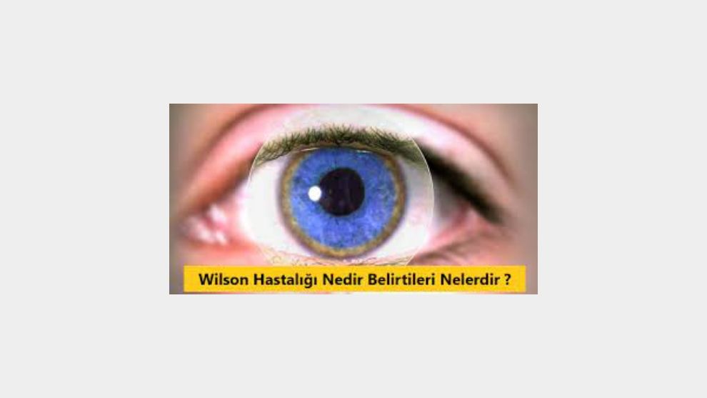 Wilson hastalığı nedir?